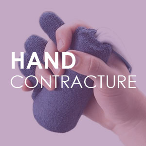 Hand Contracture Medical Supplies