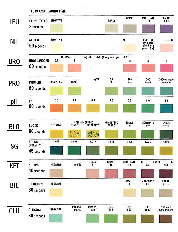 Multistix 10 Sg Urine Test Strips at Carol Adams blog